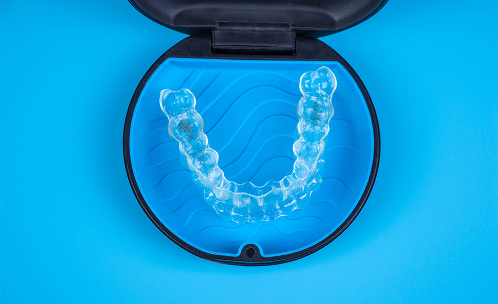 光学式スキャナーiTeroで治療後の歯並びを事前に確認可能