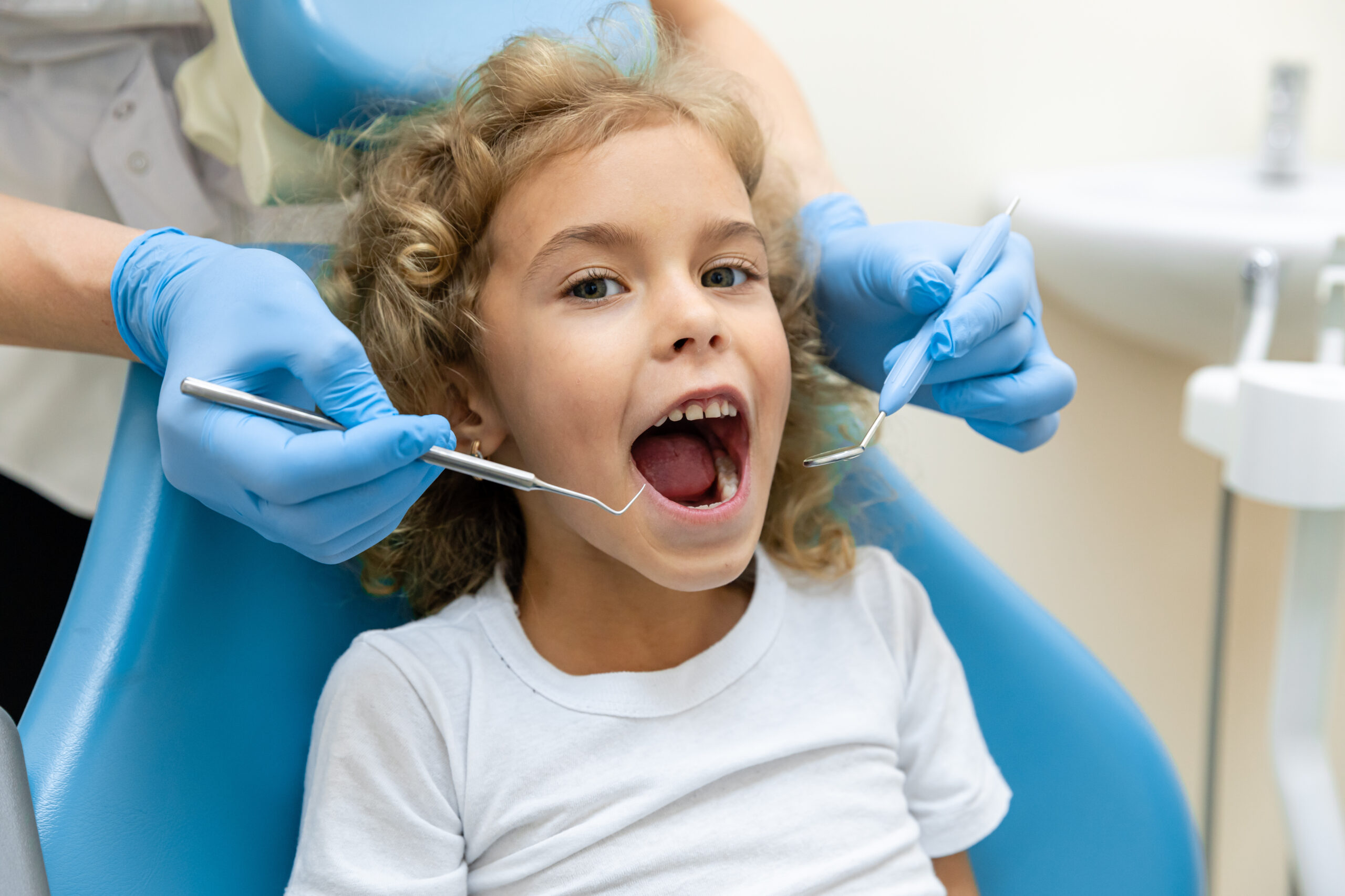 子どもが虫歯になる理由は？　子供の虫歯を放置したときの影響も解説