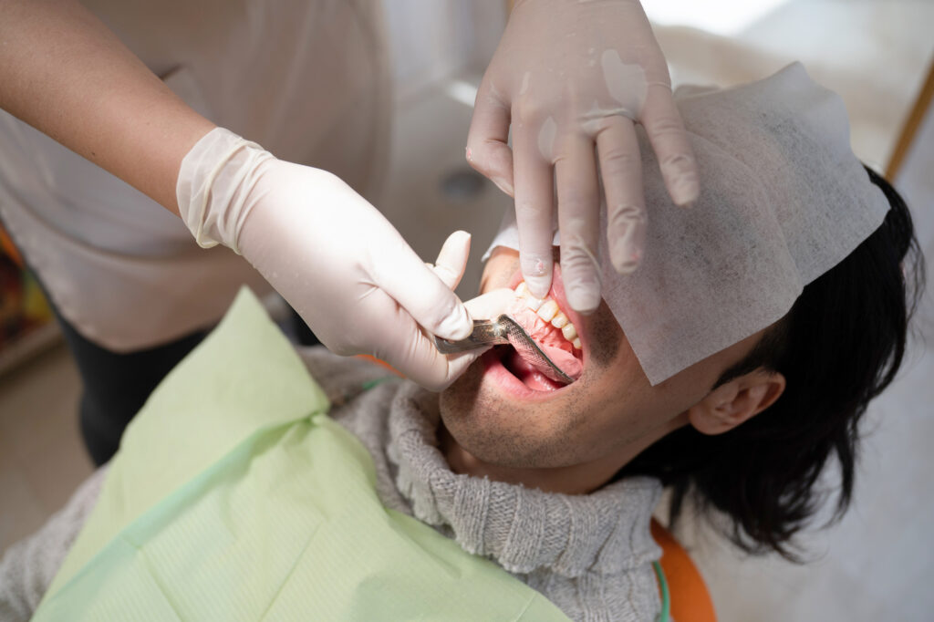 歯を削る治療